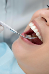 Igiene dentale